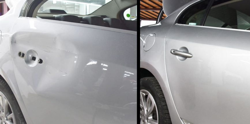 Boyasız Göçük Düzeltme